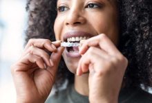Unveiling the Magic of Clear Fusion Aligners: Your Path to a Radiant Smile